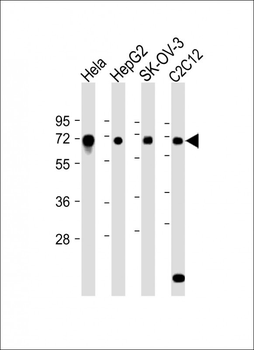 Mouse Dyrk2 Antibody (C-term)