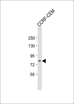 ADAM11 Antibody (N-term)