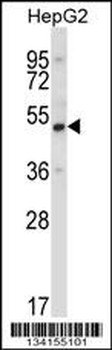 UBP1 Antibody (Center)