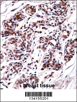 UBP1 Antibody (Center)