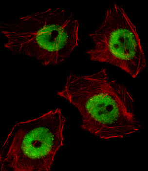 UBP1 Antibody (Center)