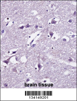 SEC22B Antibody (Center)