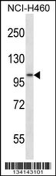 ADAM8 Antibody (N-term)