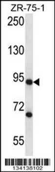 CSTF3 Antibody (C-term)