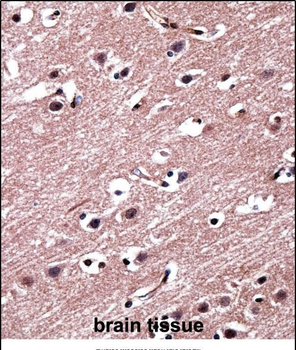 RORB Antibody (C-term)