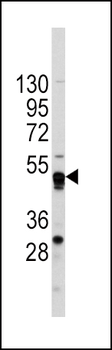 GATA4 Antibody (C-term)