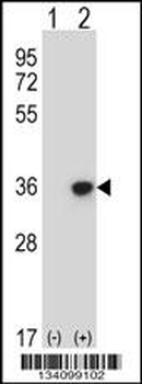 DLX4 Antibody (Center)