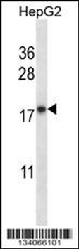 CYB5A Antibody (Center)