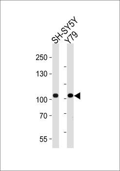 CDH8 Antibody (N-term)