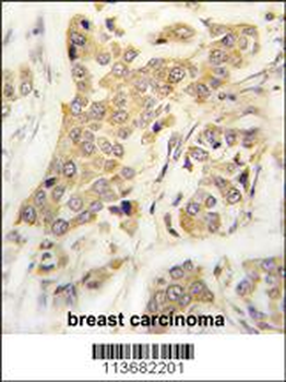 CDH8 Antibody (N-term)