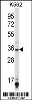 SIRT6 Antibody (C-term)
