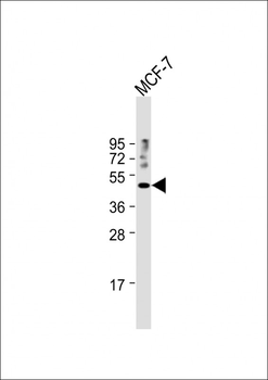 SUV39H1 Antibody (N-term)