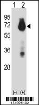 BIRC3 Antibody (N-term)