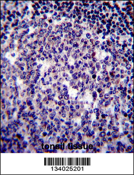 BIRC3 Antibody (N-term)