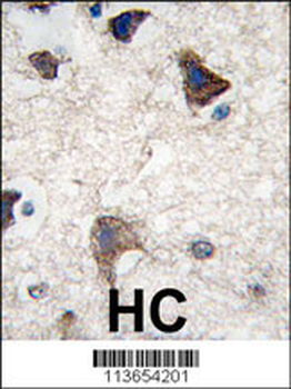 CDH4 Antibody (N-term)