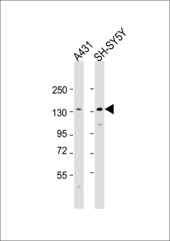 CDH4 Antibody (N-term)