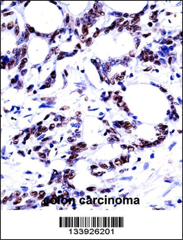 HNRNPM Antibody (N-term)