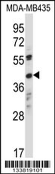 OR8K1 Antibody (C-term)