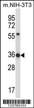 HEXIM1 Antibody (N-term)