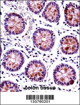 HEXIM1 Antibody (N-term)