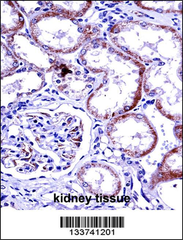 HTRA3 Antibody (Center)