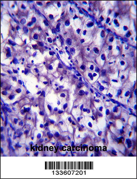 LAMB1 Antibody (C-term)
