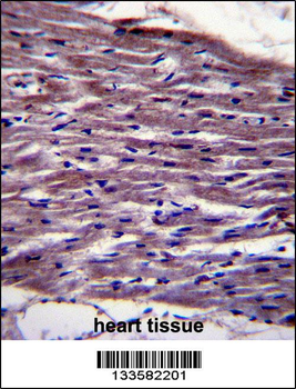 UNC45B Antibody (N-term)