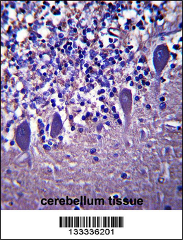 LRRC8B Antibody (N-term )