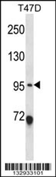 ANKS6 Antibody (Center)