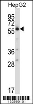 SLC30A1 Antibody (C-term)