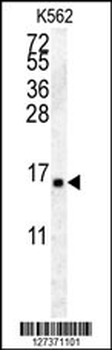 HIST2H2AA4 Antibody (C-term)
