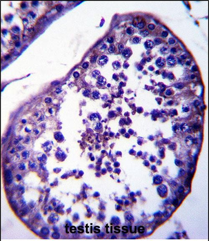 SPATA18 Antibody (N-term)