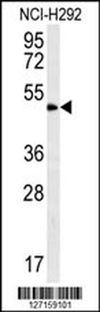 ZNF154 Antibody (N-term)