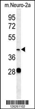 VASH2 Antibody (C-term)