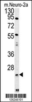 LYPL1 Antibody (Center)