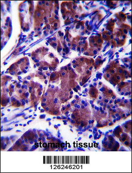 LYPL1 Antibody (Center)