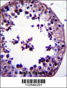 TSNAX Antibody (N-term)