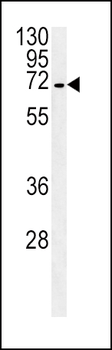 SLC22A1 Antibody (C-term)