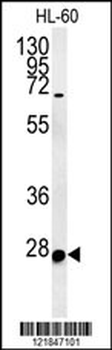 C10orf63 Antibody (Center)