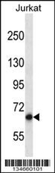 Mouse Pan3 Antibody (C-term)
