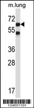 Mouse Nlk Antibody (C-term)