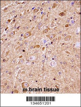 Mouse Nlk Antibody (C-term)