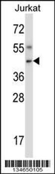 Mouse Nim1 Antibody (C-term)