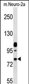 Mouse Nek8 Antibody (C-term)