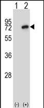 Mouse Nek8 Antibody (C-term)