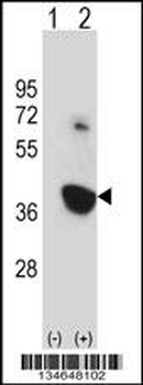 Mouse Nek6 Antibody (C-term)