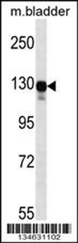 Mouse Map3k6 Antibody (N-term)