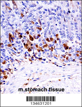 Mouse Map3k6 Antibody (N-term)