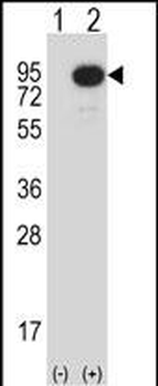 Mouse Map3k2 Antibody (N-term)