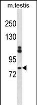 Mouse Itk Antibody (N-term)